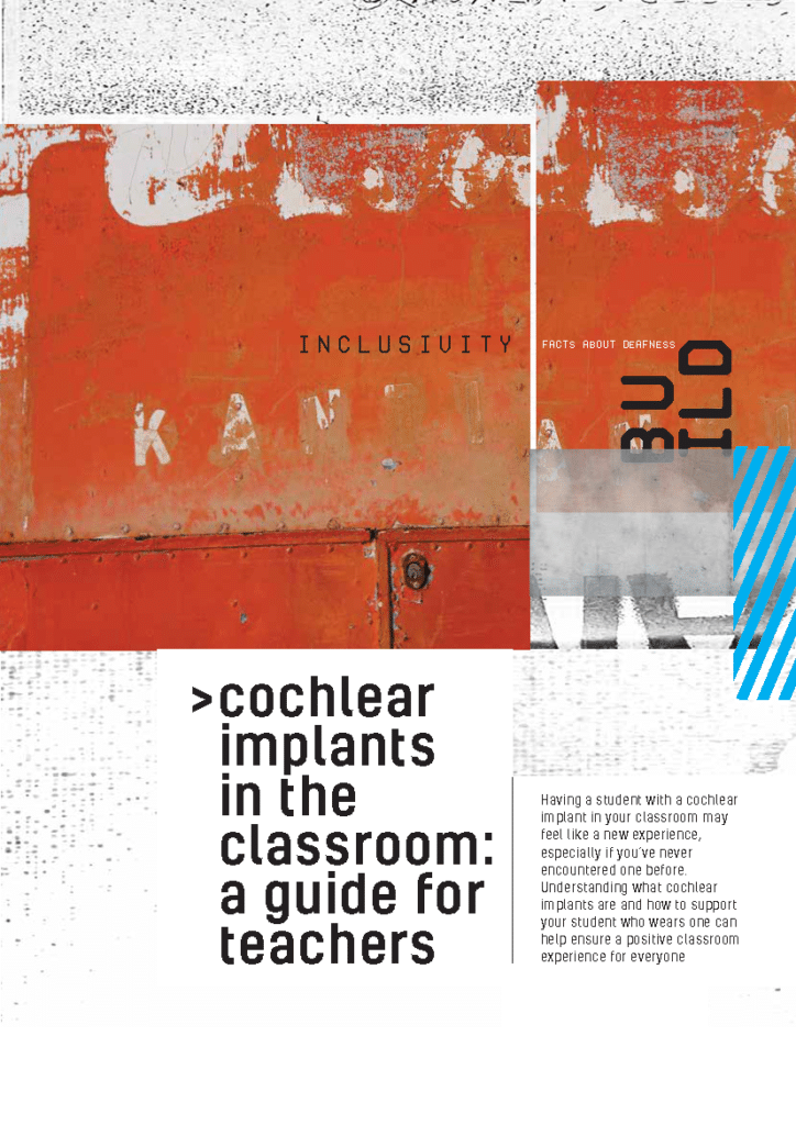 Cochlear implants
