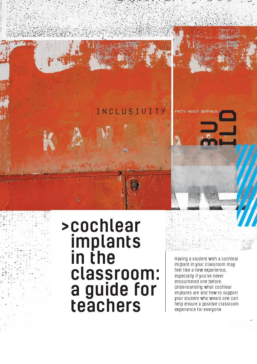 Cochlear implants